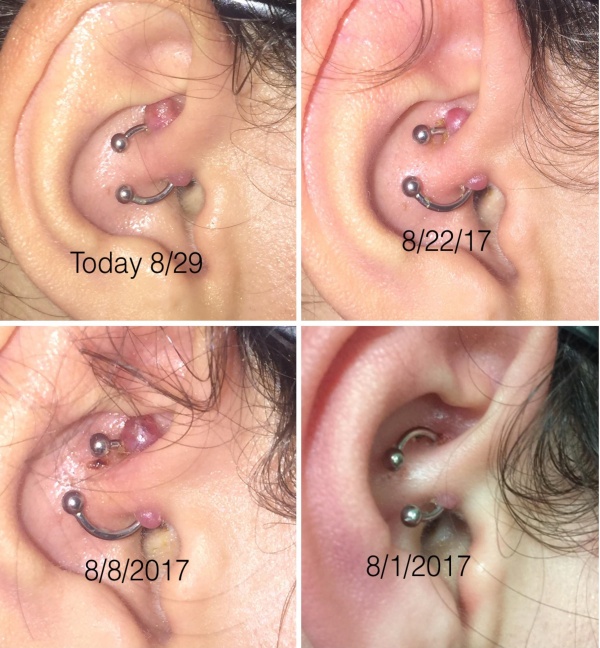 Daith Piercing: The Complete Experience Guide With Meani