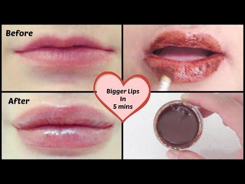 How To Get Fuller Lips Naturally