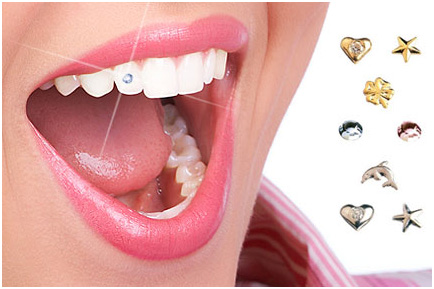 Dental jewelry - Websi