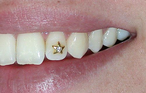 Tooth Jewelry |  tooth jewel